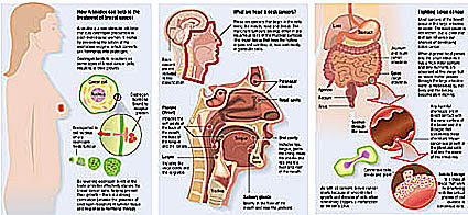 medical illustration of cancer