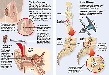 medical ear illustration artwork