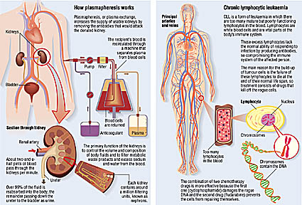 medical illustration leukaemia